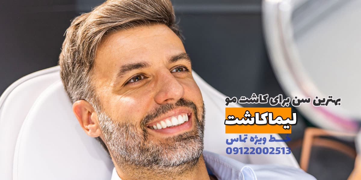 بهترین سن برای کاشت مو